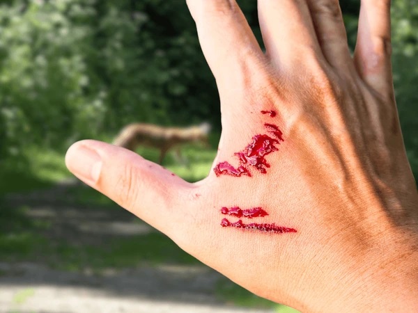 Nằm mơ thấy mình bị chảy máu là điềm gì, con gì phát tài?